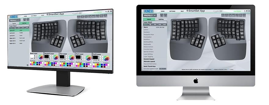 Ergonomic split keyboard on a desk, enhanced for comfort and adjustable typing position. Ideal for office setups.