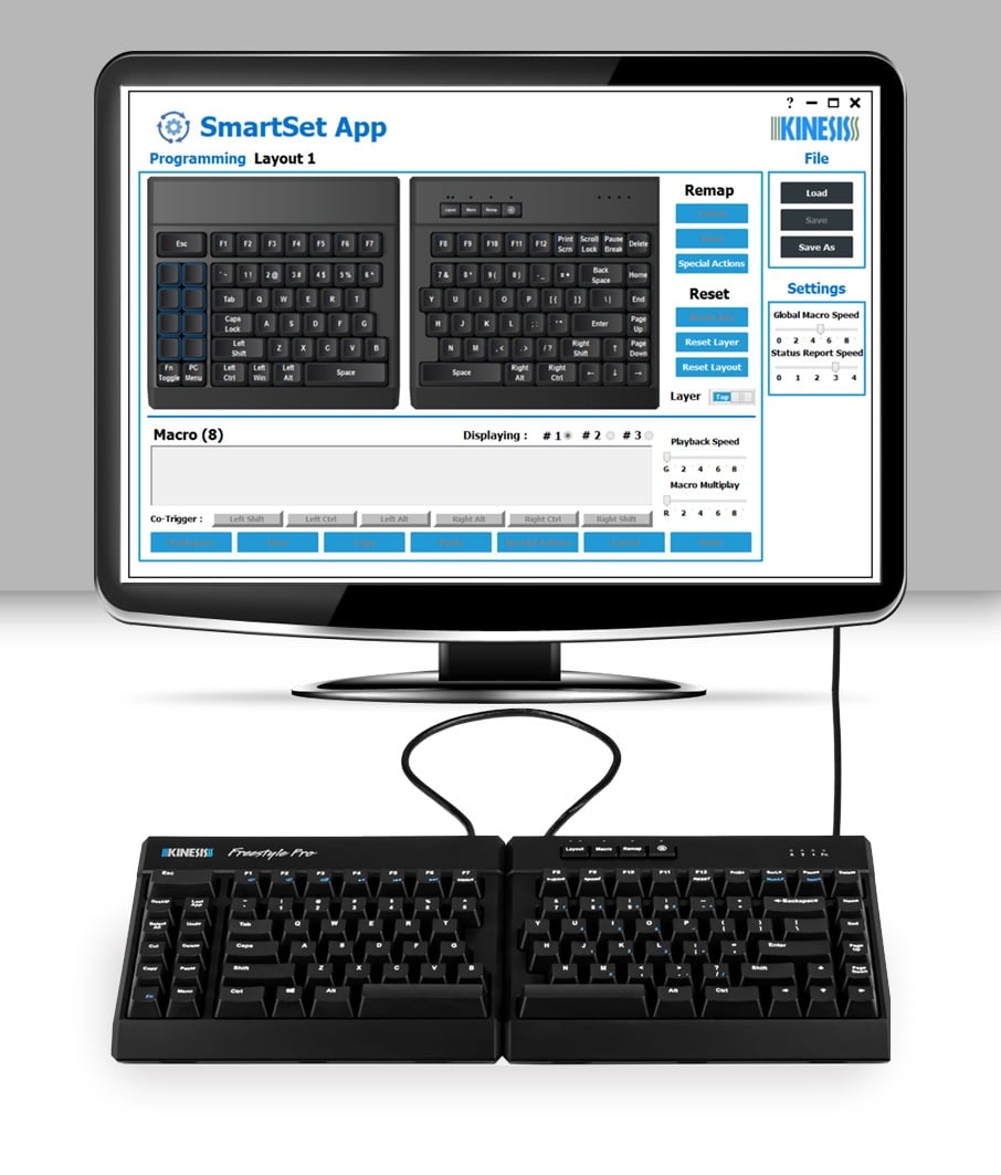 Ergonomic split keyboard with SmartSet App for customizable programming on a monitor screen.