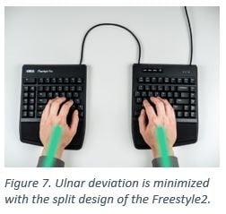 Hands typing on a split ergonomic keyboard to reduce ulnar deviation, featuring the Freestyle2 design.