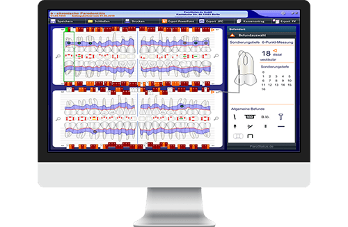 Dental software interface on computer screen showing periodontal chart and tooth measurements.