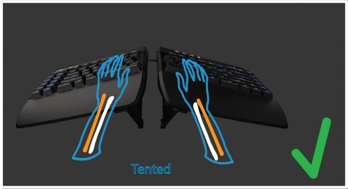 Ergonomic tented keyboard with illustrated wrist positioning for comfortable typing and reduced strain.