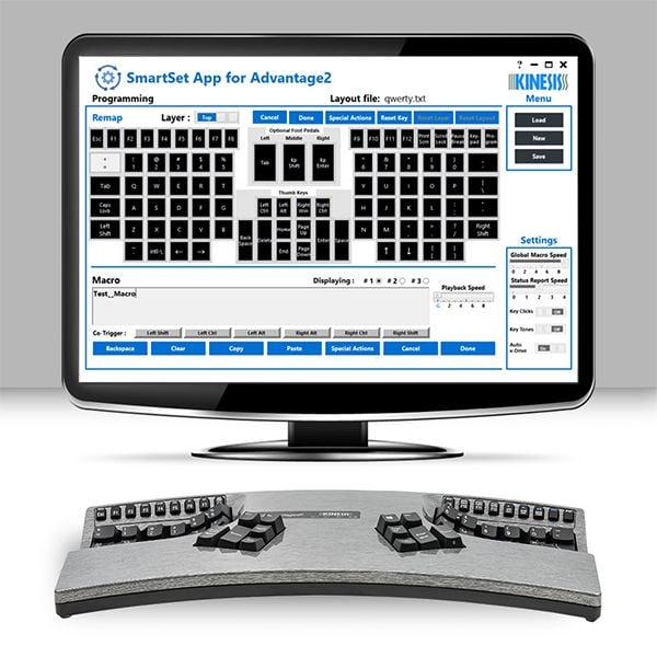 Ergonomic keyboard with SmartSet App on screen, showcasing customization options for enhanced user experience.